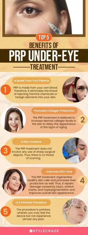 top 5 benefits of prp under eye treatment(infographic)