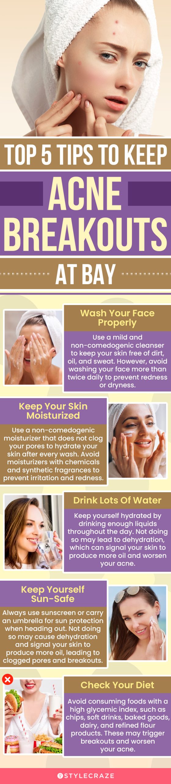 top 5 tips to keep pimples and acne at bay (infographic)