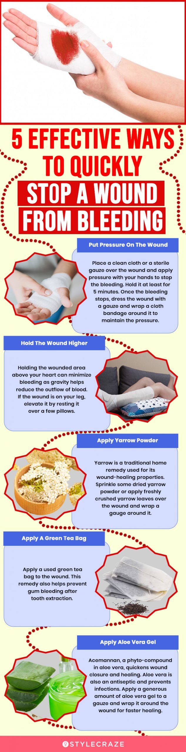 5 effective ways to quickly stop a wound from bleeding (infographic)
