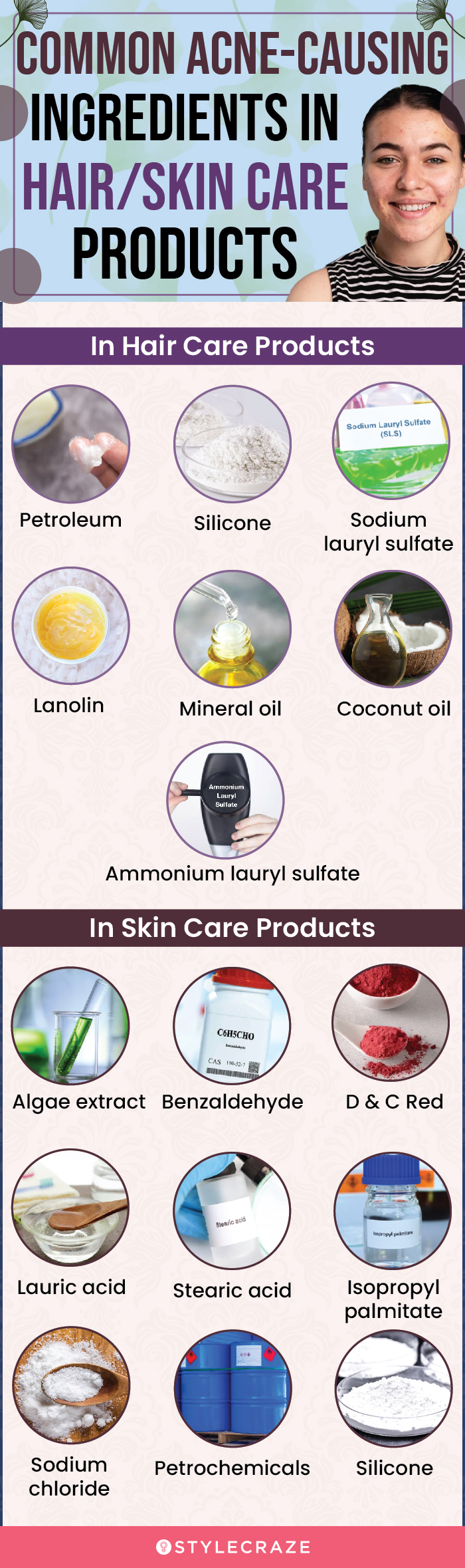 common acne causing ingredients in hair skin care products (infographic)