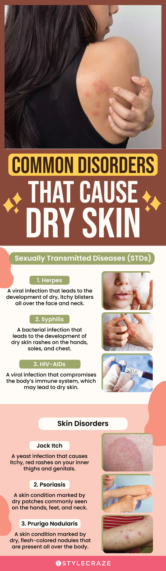 common disorders that cause dry skin (infographic)