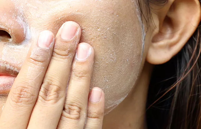 How Does Exfoliation Help Your Skin