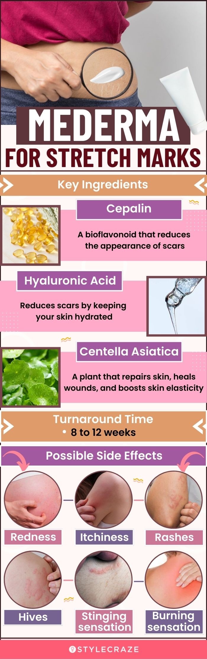mederma for stretch marks (infographic)