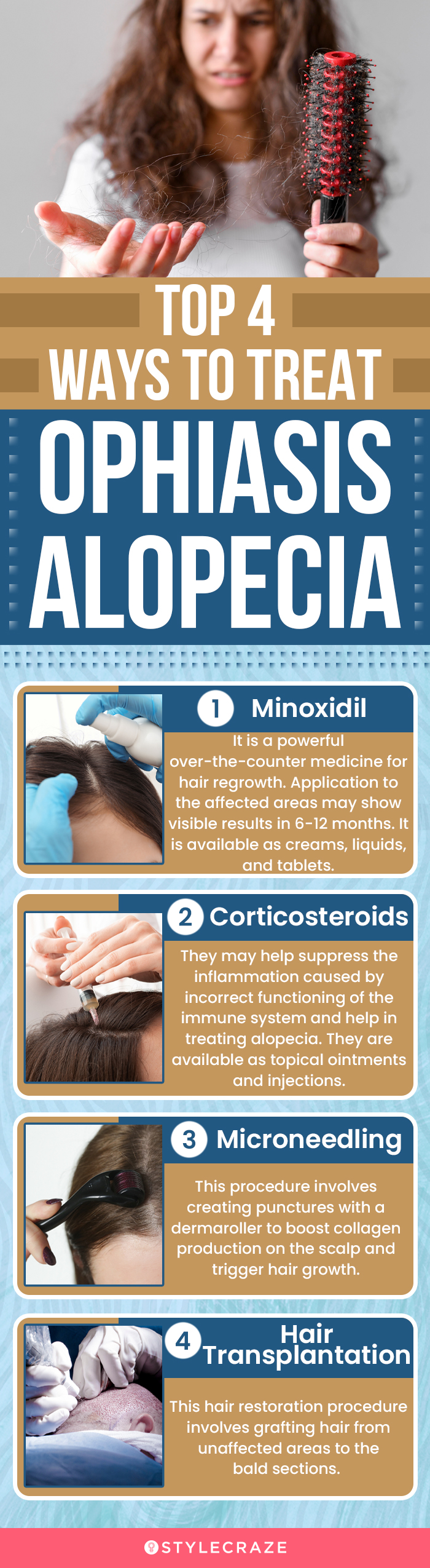 top 4 ways to treat ophiasis alopecia (infographic)