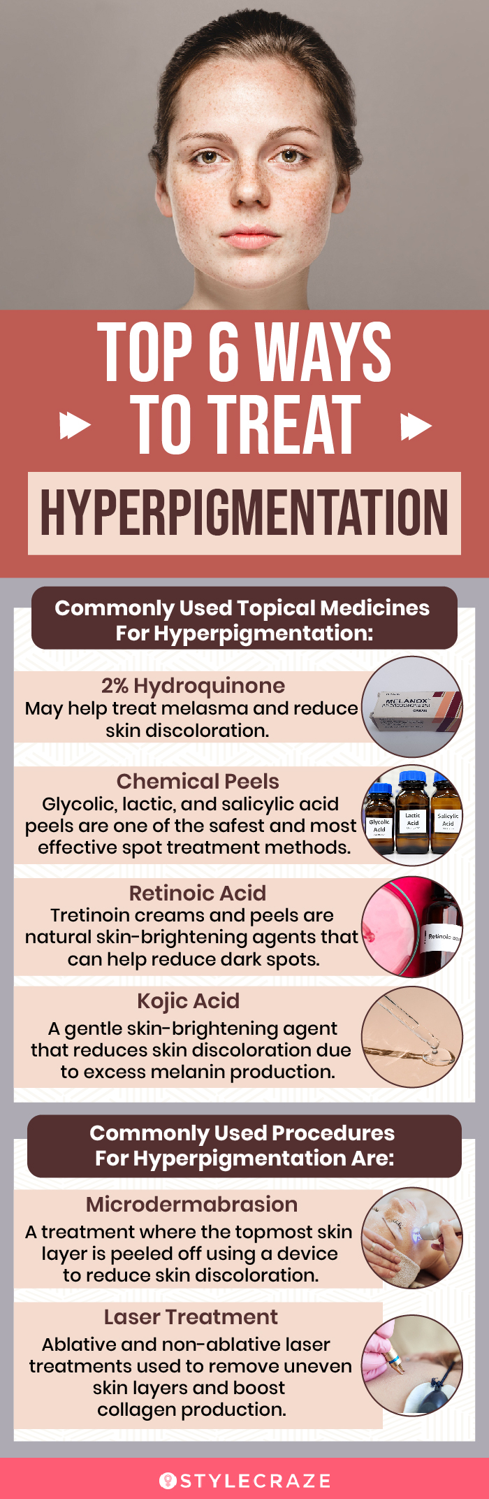 top 6 ways to treat hyperpigmentation (infographic)