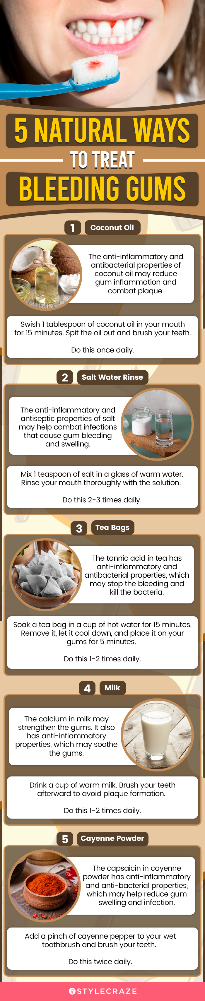 5 natural ways to treat bleeding gums (infographic)