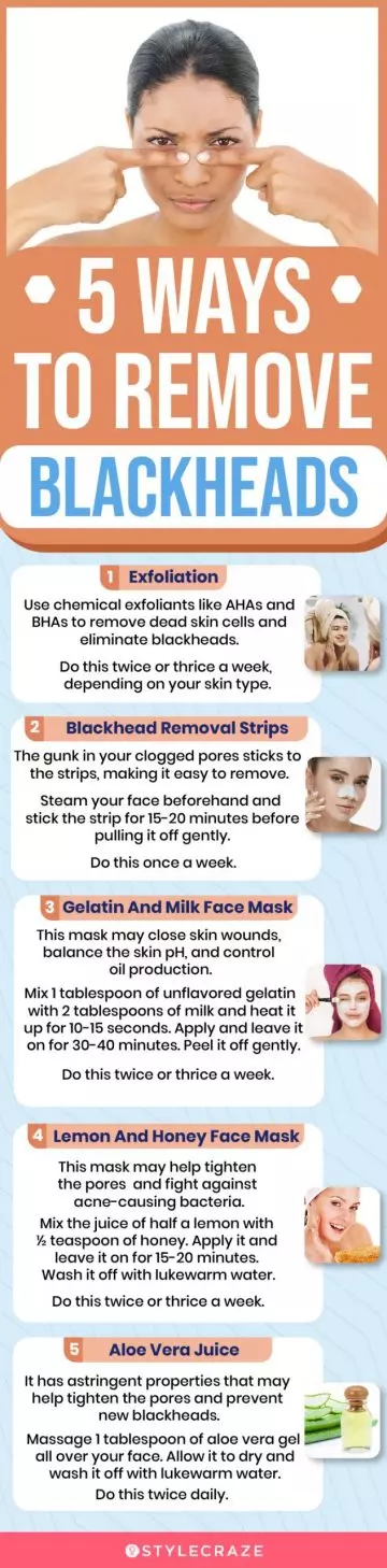 5 ways to remove blackheads(infographic)