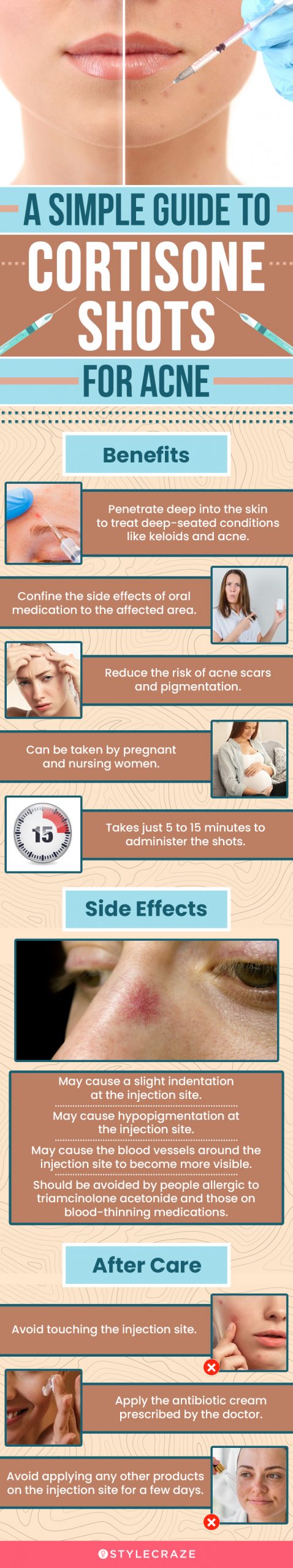 a simple guide to cortisone shots for acne (infographic)