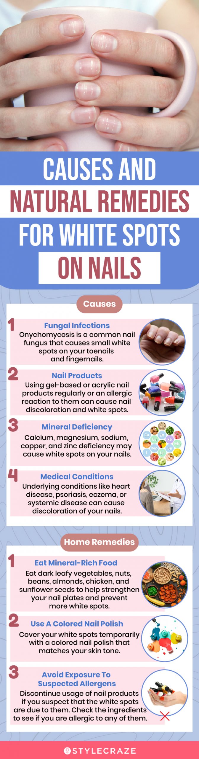 causes and natural remedies for white spots on nails (infographic)