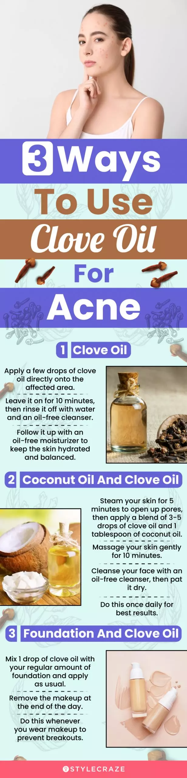 clove oil for acne (infographic)