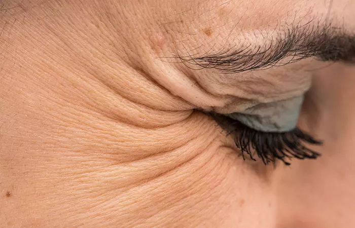 Squeeze Your Eyes Shut