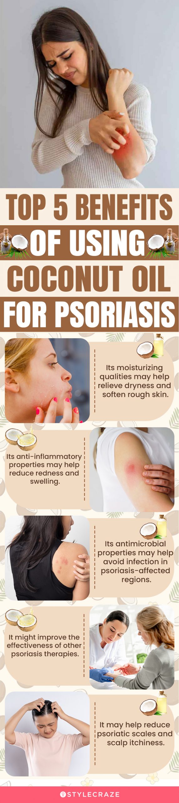 top 5 benefits of using coconut oil for psoriasis (infographic)