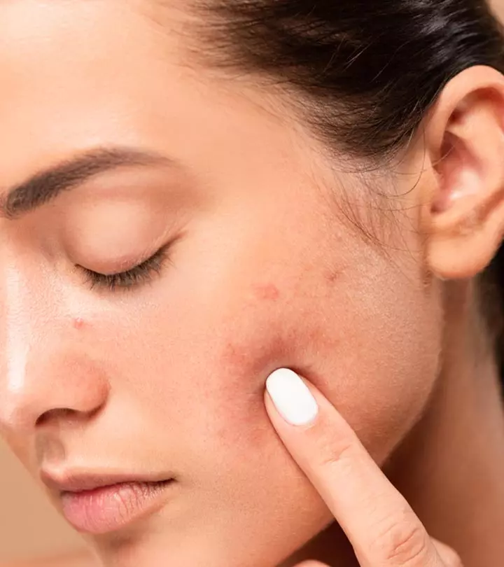 6 Things We Do Everyday That Silently Wreck Our Skin