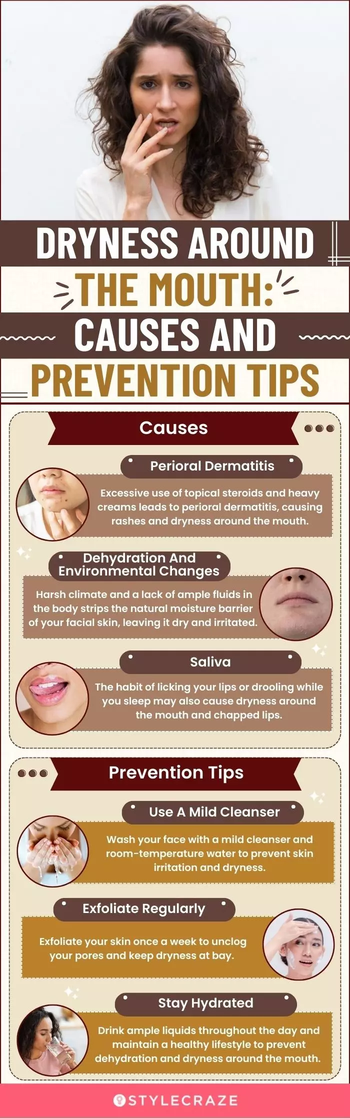 dryness around the mouth causes and prevention tips (infographic)