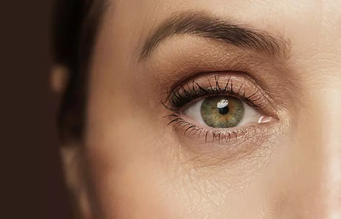 Eyebrow Lifts