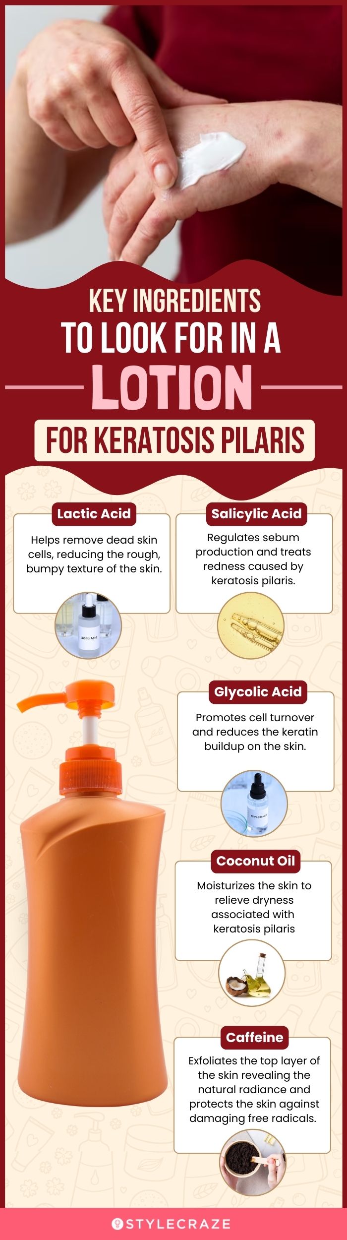 Key Ingredients To Look For In A Lotion For Keratosis Pilaris (infographic)