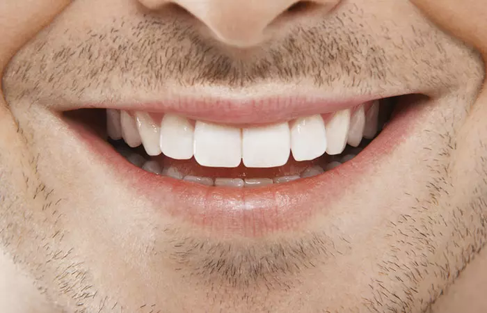 Men Have Larger Teeth