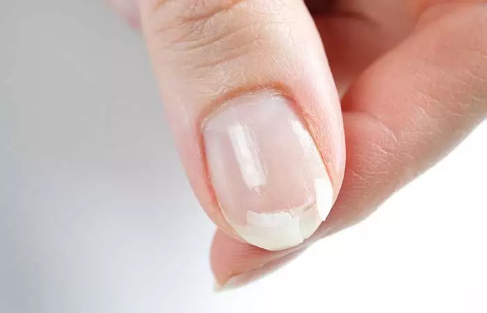 Skin And Nail Problems