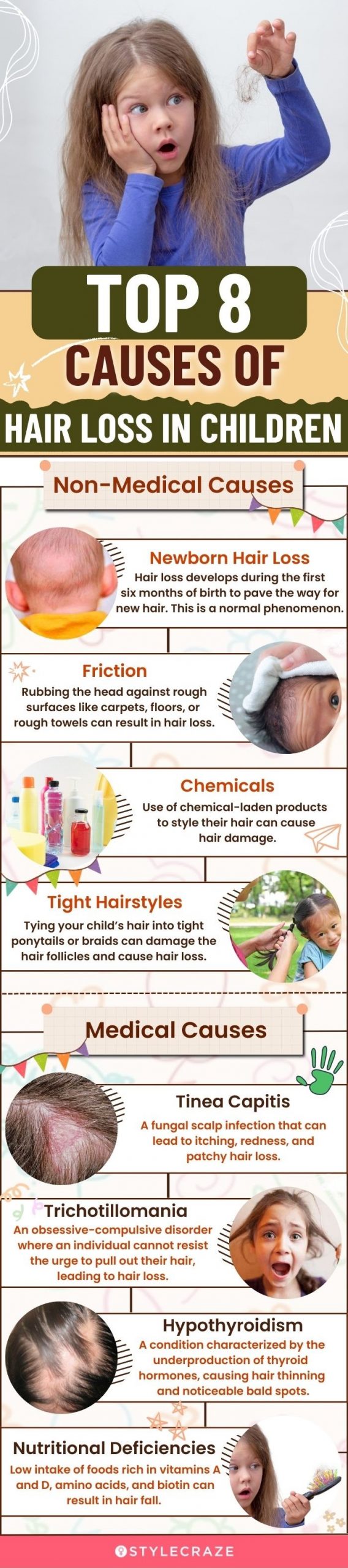 top 8 causes of hair loss in children (infographic)