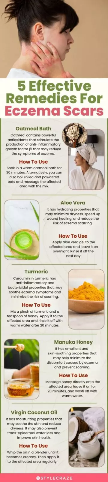 5 effective remedies for eczema scars (infographic)
