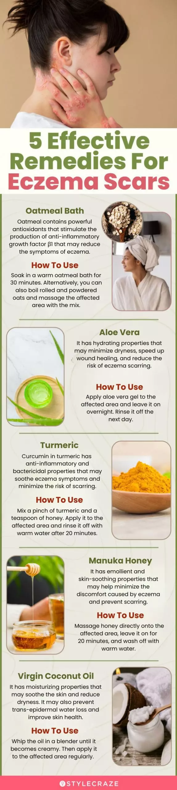 5 effective remedies for eczema scars (infographic)