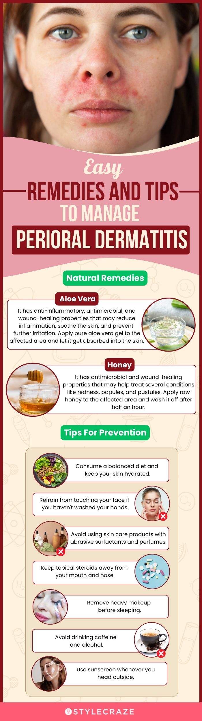easy remedies and tips to manage perioral dermatitis (infographic)