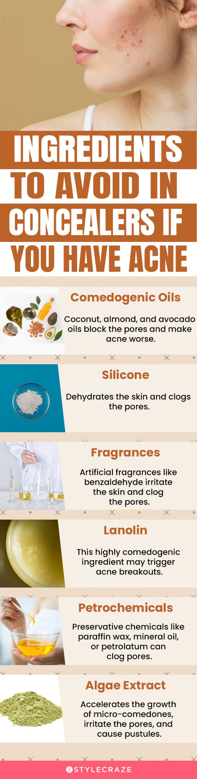 Ingredients To Avoid In Concealers If You Have Acne (infographic)