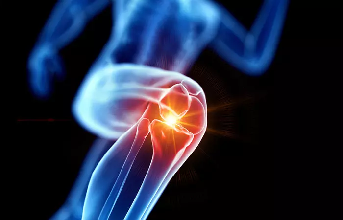 Anti-inflammatory diet promotes joint health