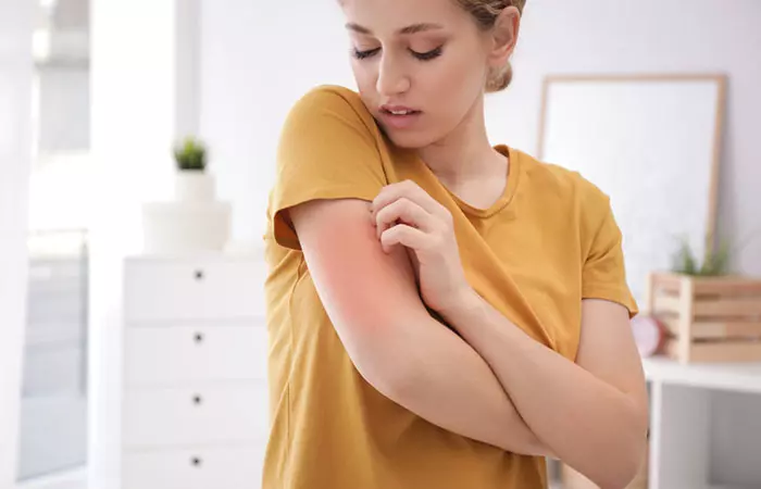 Acknowledge Your Skin Allergies