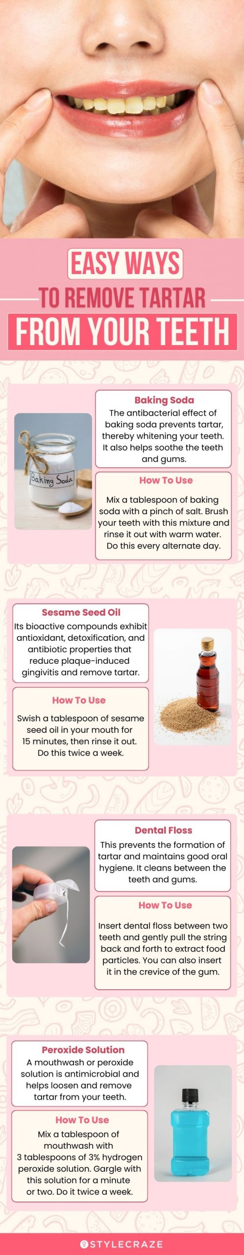 easy ways to remove tartar from your teeth (infographic)