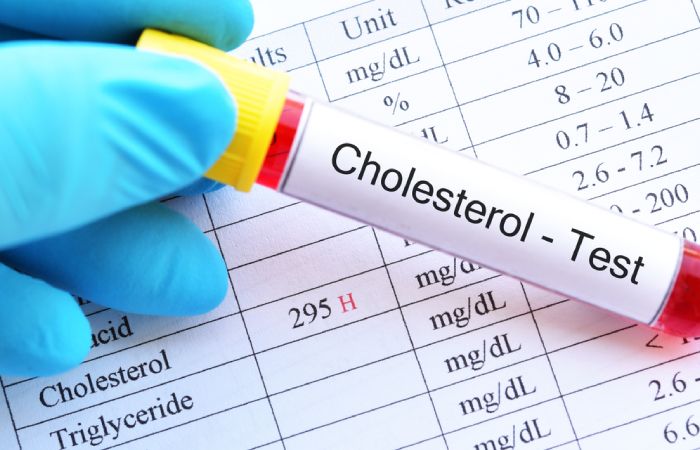 High Cholesterol test