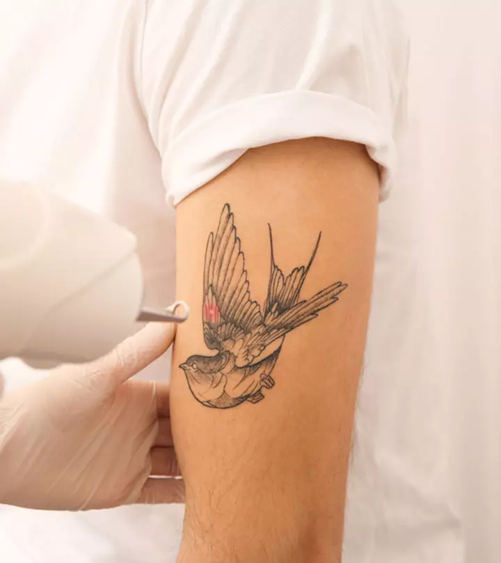 Laser treatment for fading a tattoo