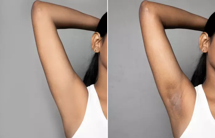Why Does Pampering Your Underarms Matter