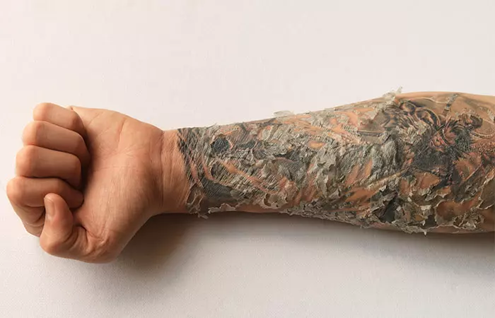 A person experiencing peeling skin during tattoo healing