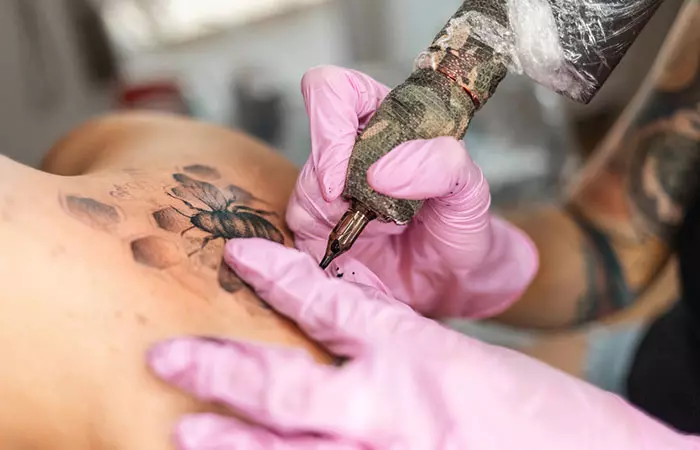 A person getting tattooed on psoriasis patches