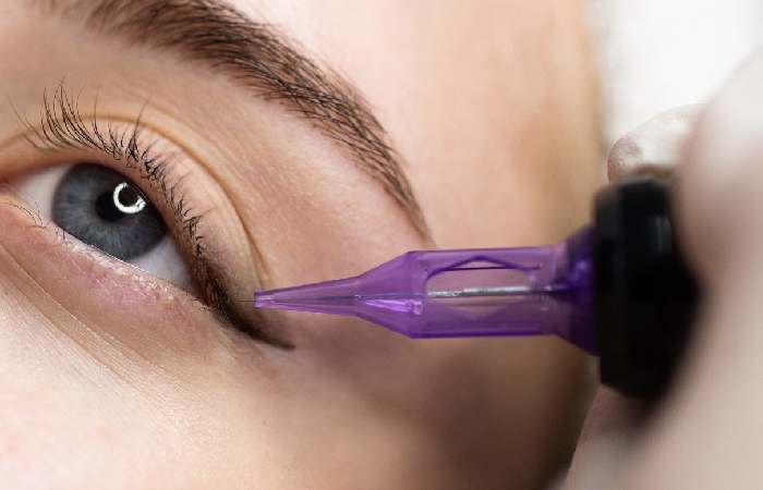 A woman getting a scleral tattoo
