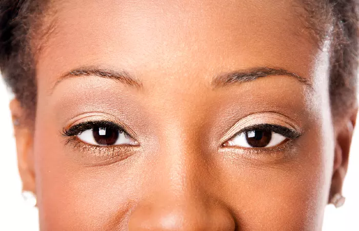 Almond-Shaped Eyes