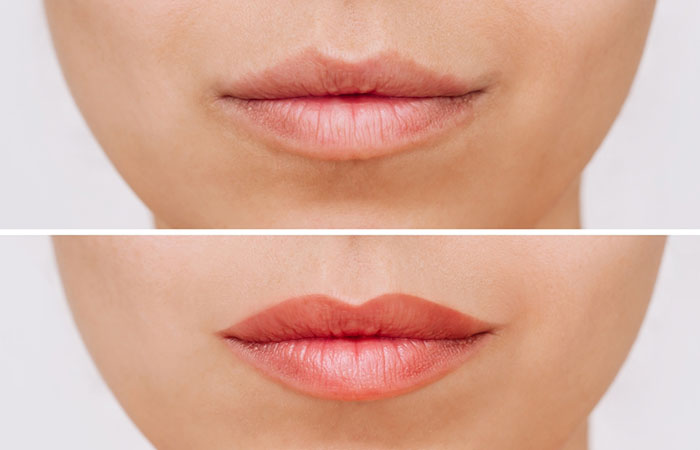 Before and after a lip blush tattoo treatment