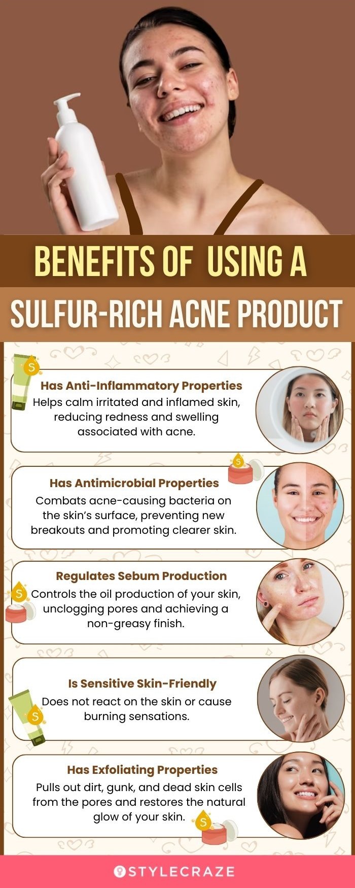Benefits Of Using A Sulfur-Rich Acne Product (infographic)