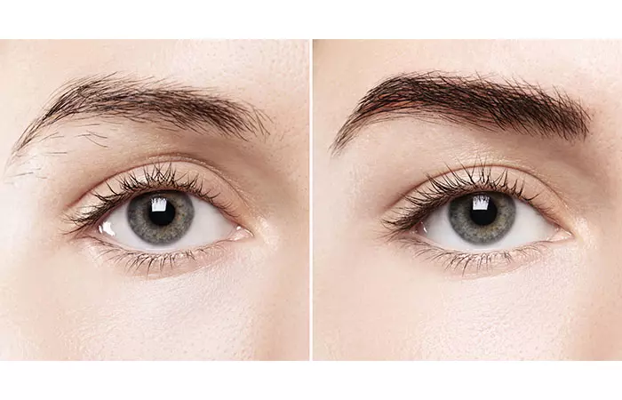  A before and after picture of a woman who underwent eyebrow microblading 