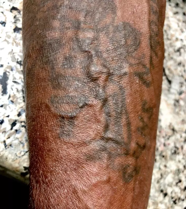 Tattooed leg with varicose veins