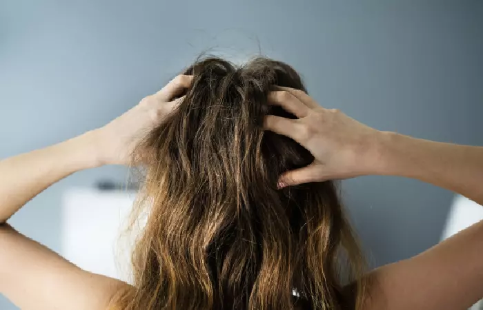 Understanding The Causes Of Itchy Scalp