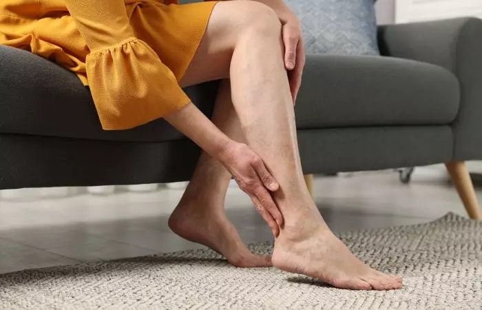 Woman examining the varicose veins in her leg