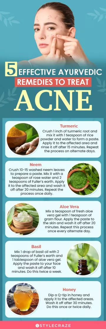 5 ayurvedic pimple cure remedies (infographic)