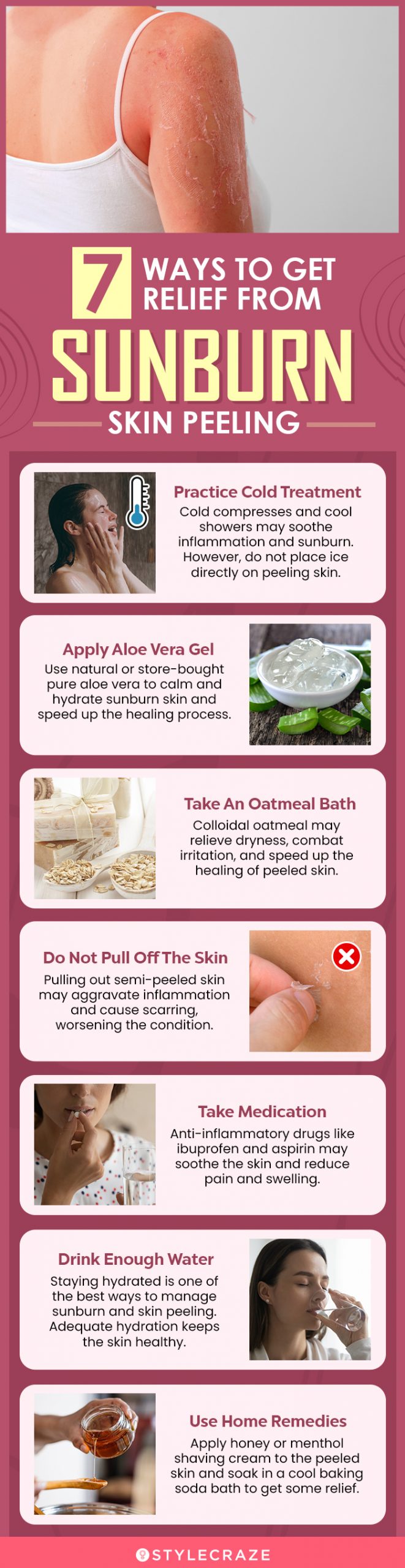 7 ways to get relief from sunburn skin peeling (infographic)