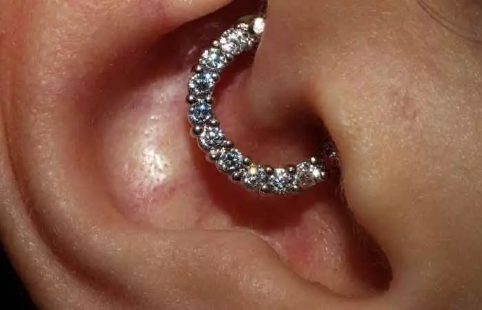 A closeup of a daith piercing for migraine