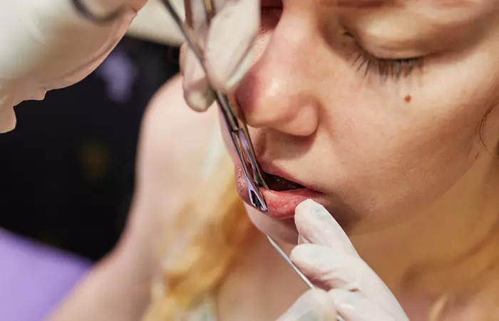 A girl getting her lips marked by a professional for a lip piercing