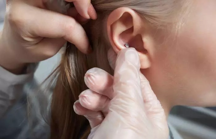 A medical professional checking a woman’s ear piercing