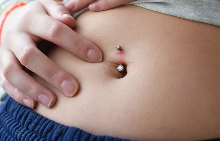 A potential infection on a belly button piercing