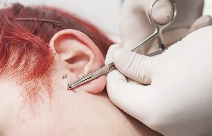 A professional removing a surface piercing